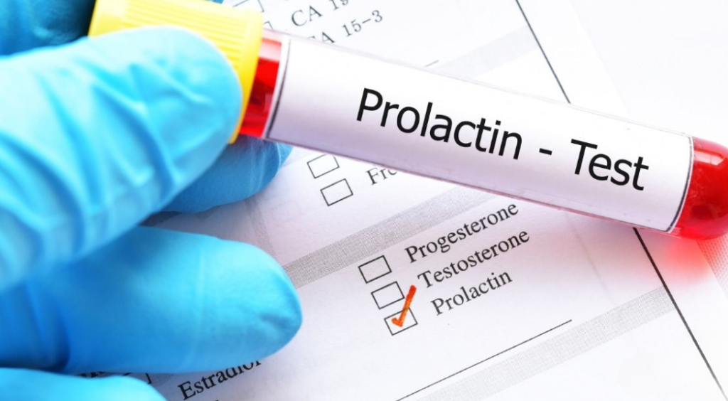Prolaktyna – normy