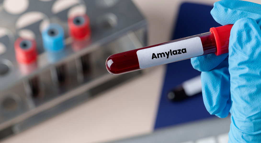 amylaza