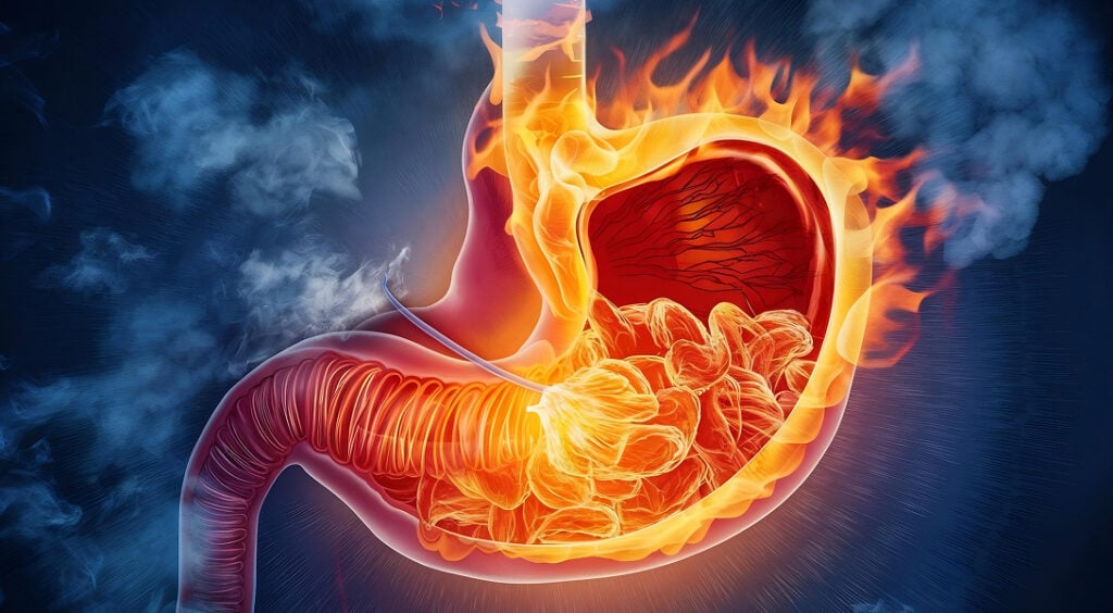 Co jeść przy zapaleniu żołądka – co warto, a czego nie można jeść