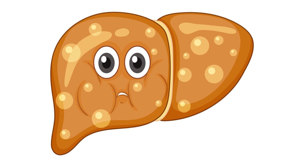 Co jeść przy marskości wątroby