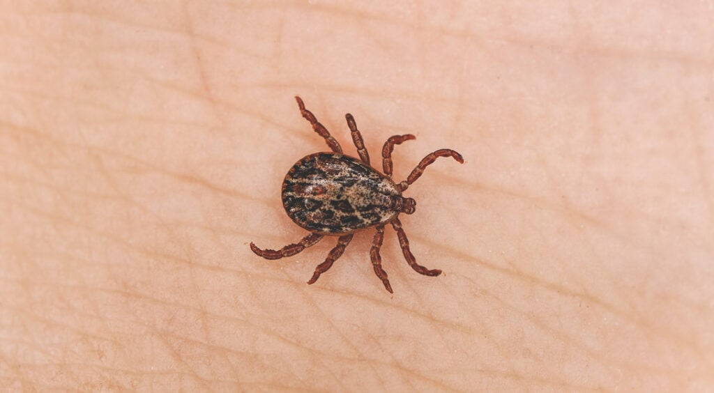 Czego nie jeść przy boreliozie